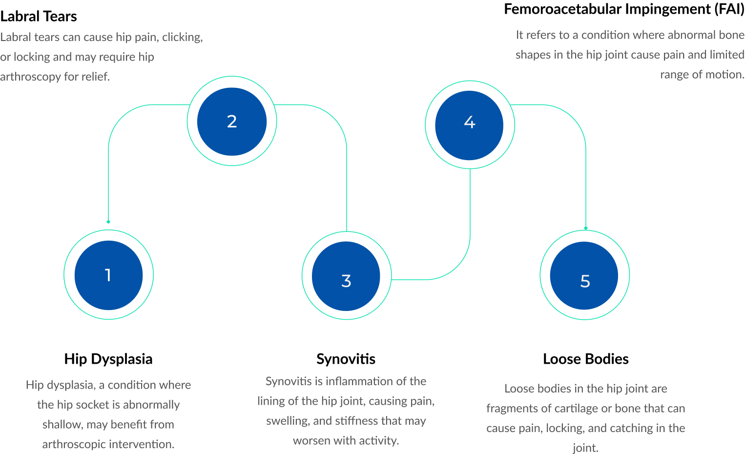Indications for Hip Joint Arthroscopy
