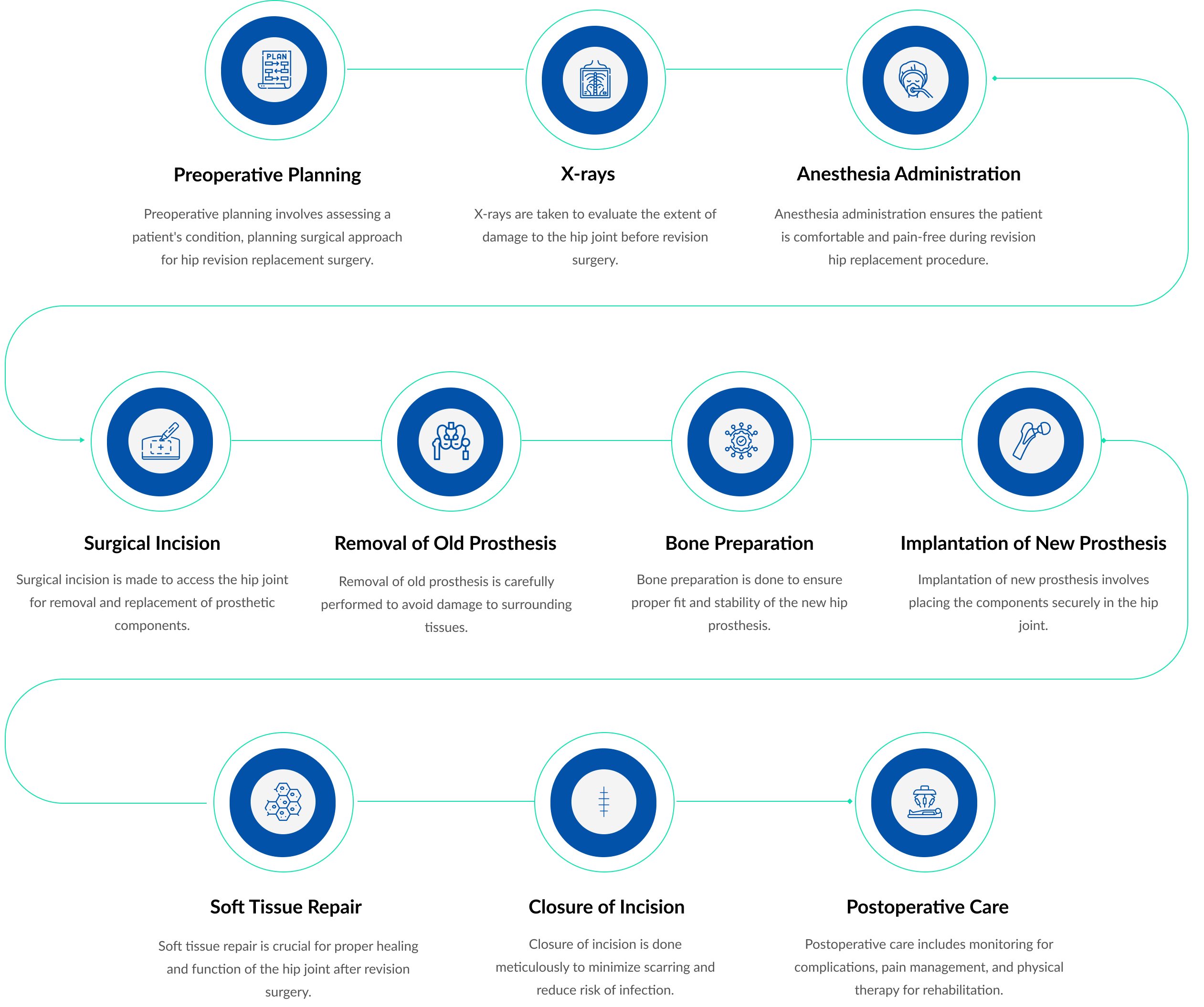 Process of Revision Hip Replacement
