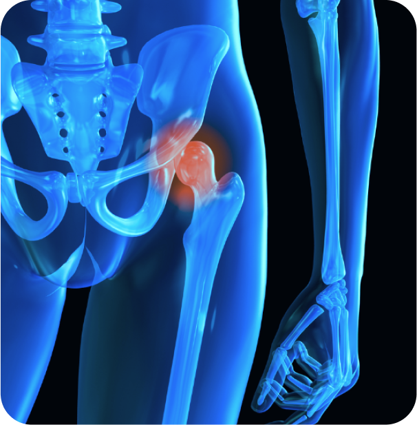 Who Needs Hip Arthroscopy