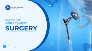 What is Partial Hip Replacement