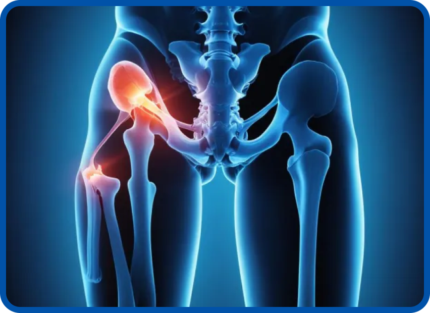 Bikini Hip Incision Replacement