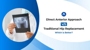 Direct Anterior Approach vs. Traditional Hip Replacement