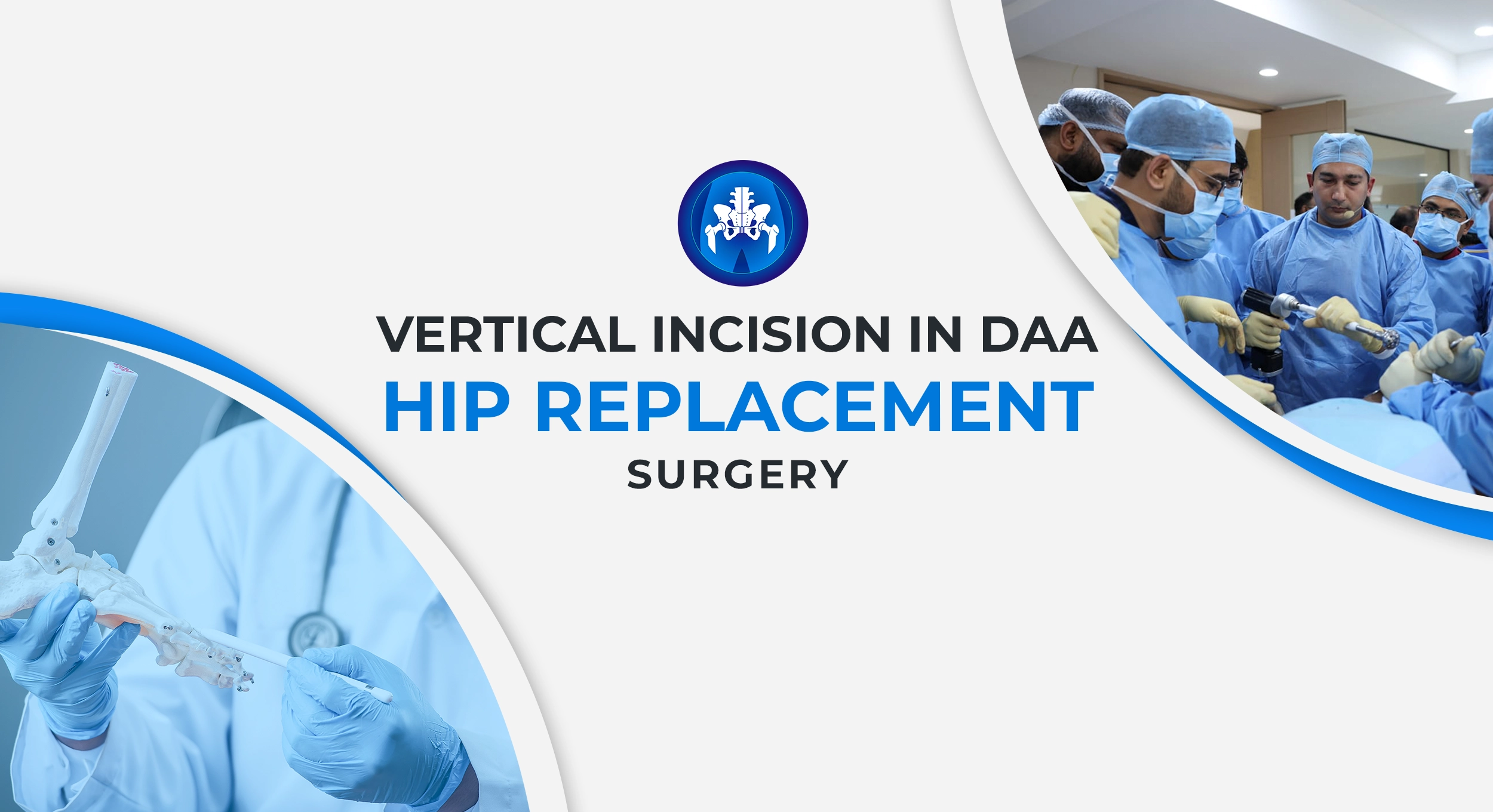 Vertical Incision in DAA Hip Replacement Surgery
