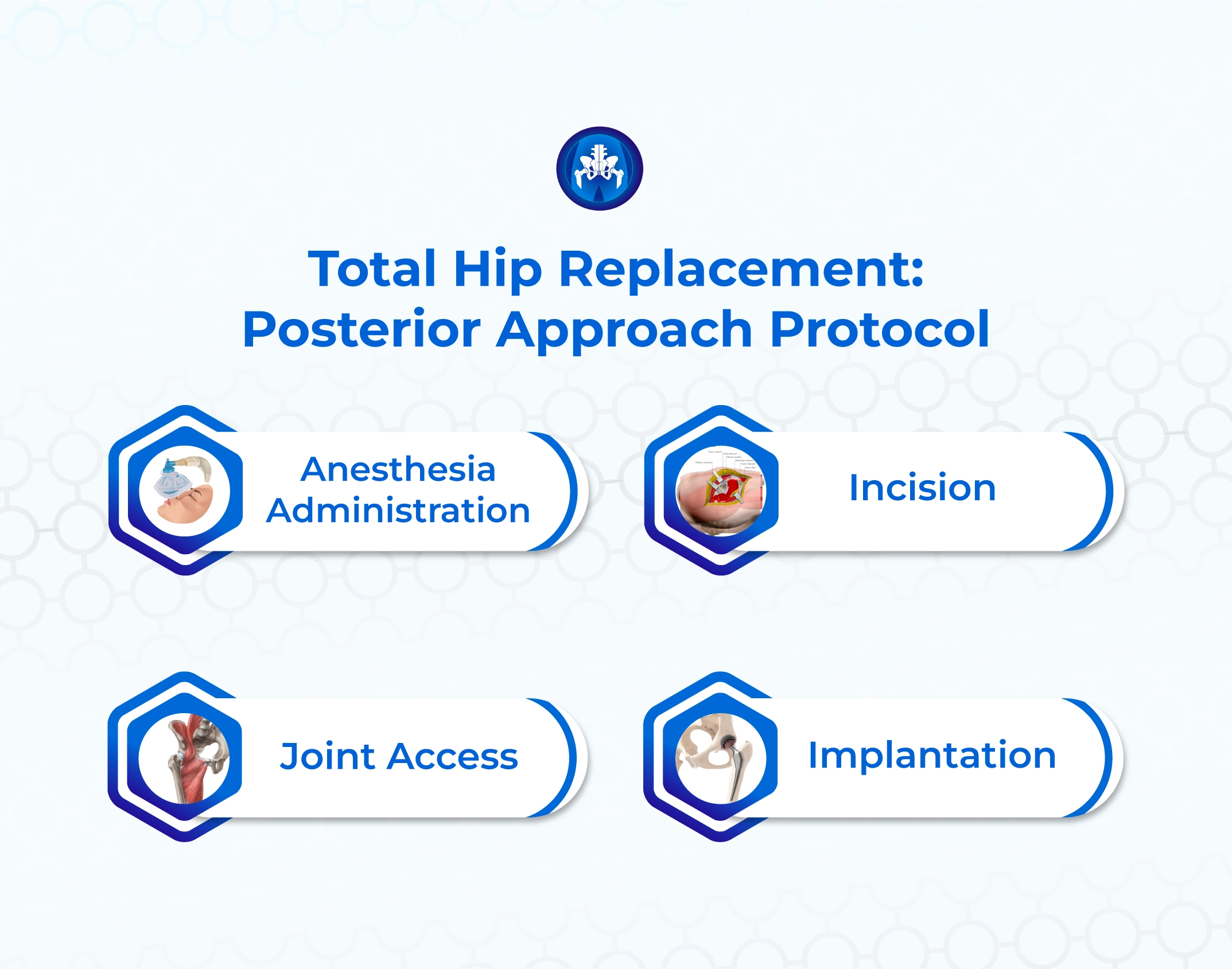 Total Hip Replacement: Posterior Approach Protocol