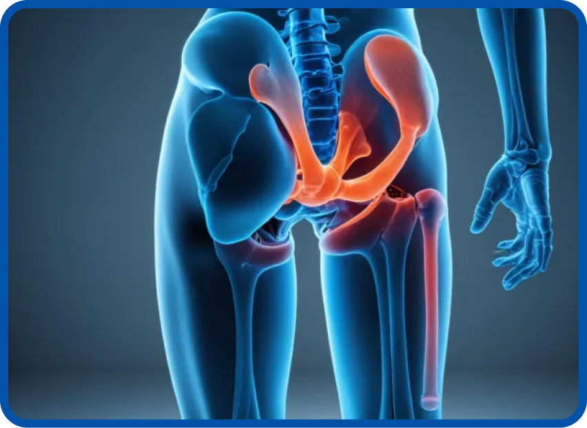 Revision Hip Replacement