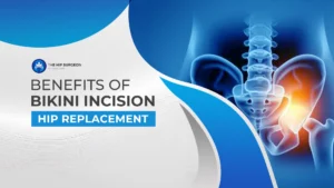 Benefits of Bikini Incision Hip Replacement